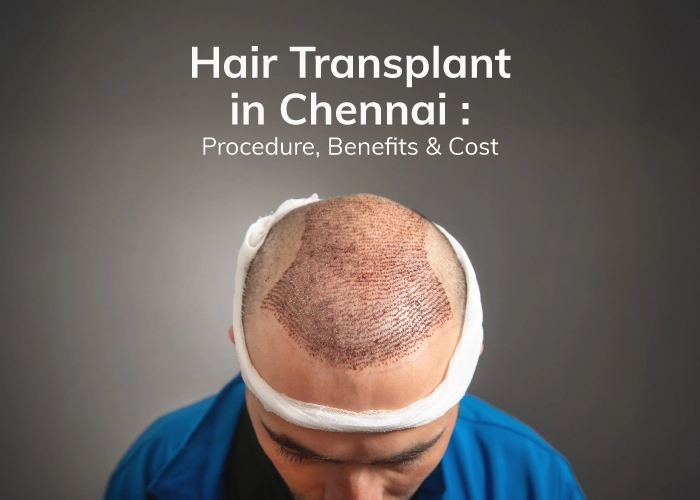 hair transplant procedure at Chennai

